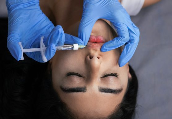 Dermal Fillers