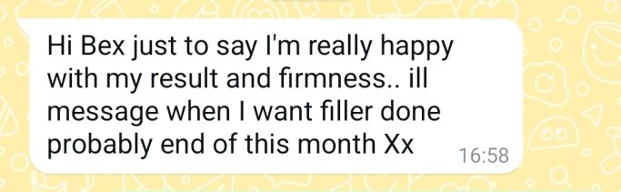 Dermal Fillers Cheeks