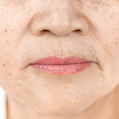 Mouth Lines