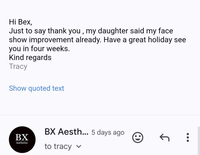 Botox Frimley, Anti-wrinkle Review, Anti-ageing Treatment near me, botox results Camberley, Anti-wrinkle feedback.