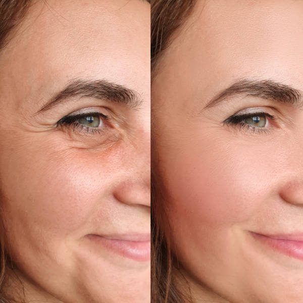 Botox near me. Anti-ageing Treatments. Fillers near me.