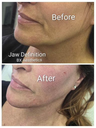 Jaw Definition