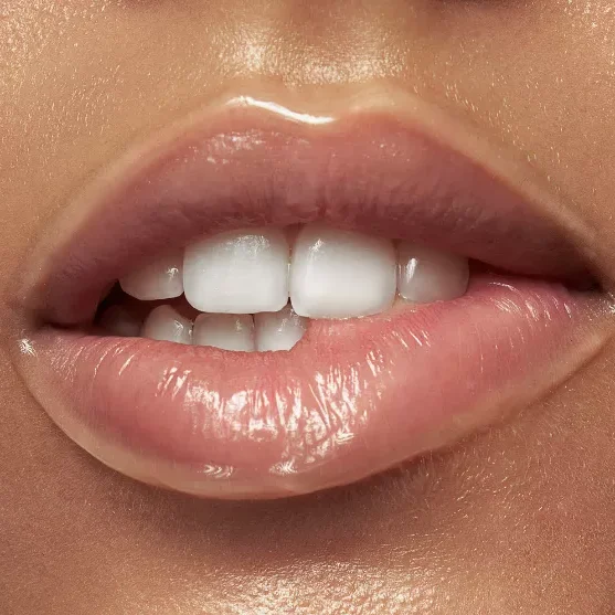 Lip Filler
